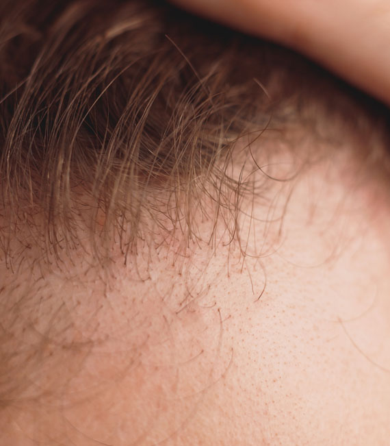 Hair Transplant Clinic